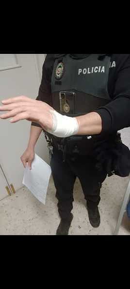 El agente que fue mordido en la mano.