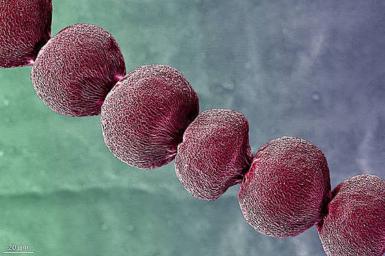 Pelo de la pequeña corona que rodea los estambres de la flor de Tradescantia, una planta muy común.