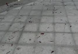 Reguero de sangre por la herida de bala.