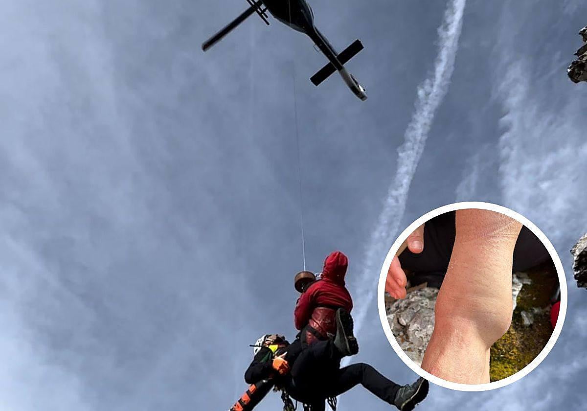 Daniela rescatada por el Greim. A la derecha, imagen de su tobillo cuando se accidentó.