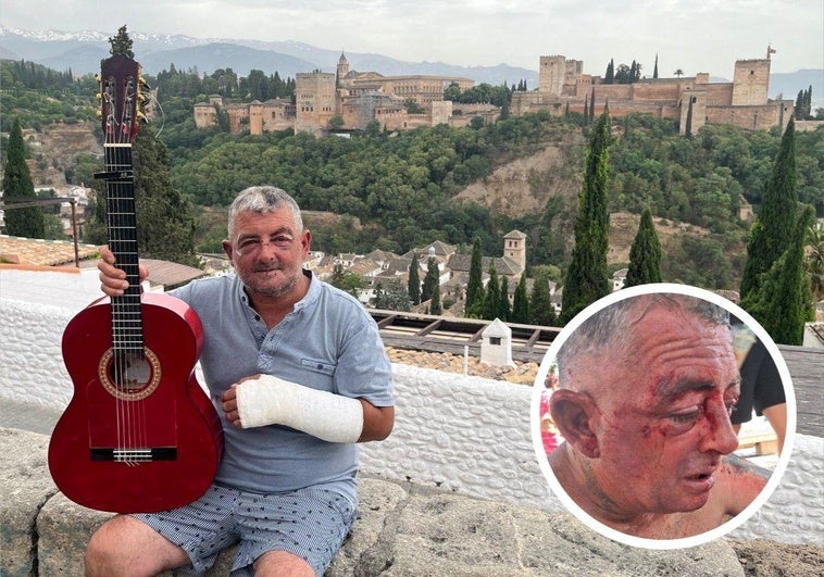 A la izquierda, Agustín este martes en el mirador. A la derecha, justo después del ataque.
