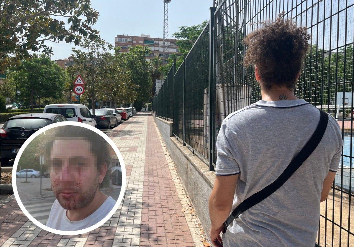 Le fracturan la nariz tras pegarle una paliza «solo por mirarlos» en el Zaidín