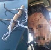 El garfio usado en la agresión y el guardia civil herido.