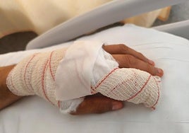 Estado de la mano del agente que sufrió la agresión en Garrucha.