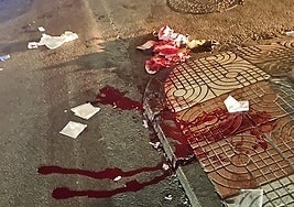 El varón tuvo que ser desplazado al Hospital de Poniente.