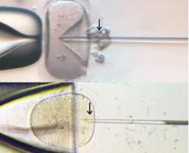 Un invento granadino que mejora la fecundación in vitro se fabricará a gran escala en Australia para el mercado asiático