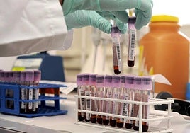 Un técnico de laboratorio examina muestras de sangre.