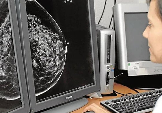 Sanidad reduce a 217 el número mujeres pendientes de pruebas del cribado.