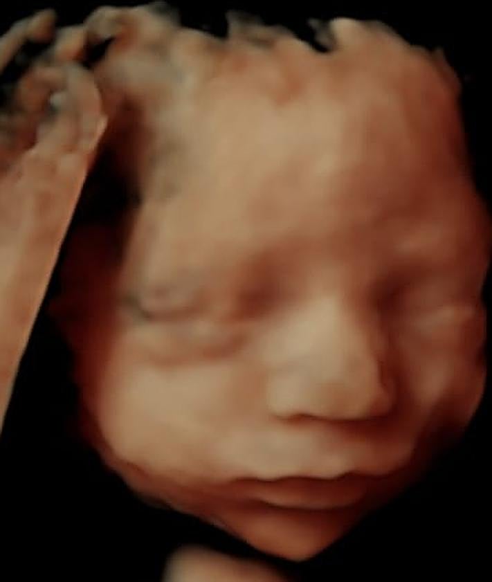 Imagen secundaria 2 - Las ecografías 5D llegan a Granada: «Generan un mayor vínculo con el bebé»