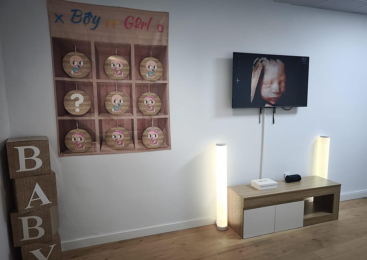 Imagen secundaria 1 - Las ecografías 5D llegan a Granada: «Generan un mayor vínculo con el bebé»