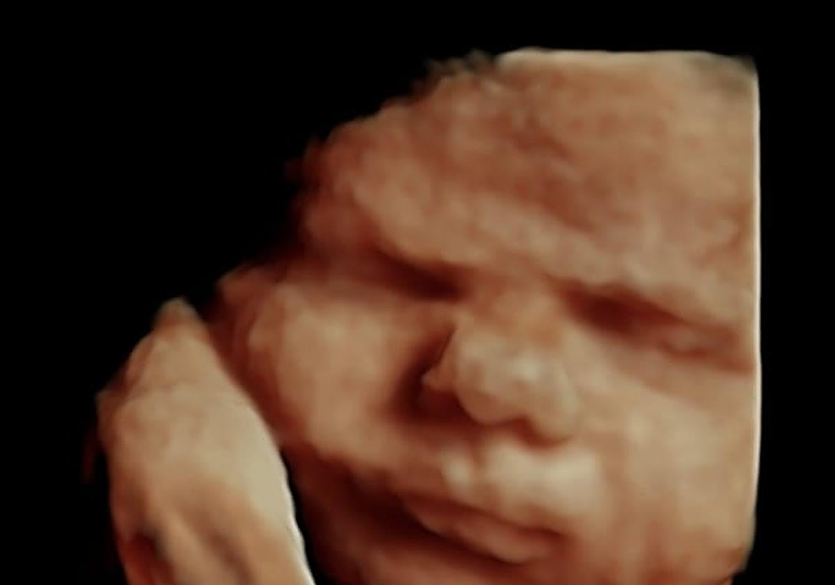 Imagen principal - Las ecografías 5D llegan a Granada: «Generan un mayor vínculo con el bebé»