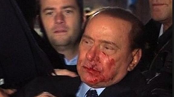 Berlusconi, tras ser agredido en Milán en 2009.
