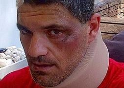 Frank de la Jungla, herido en un accidente de helicóptero