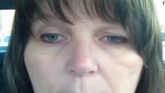 Un 'selfie' de un derrame cerebral ayuda a salvarle la vida