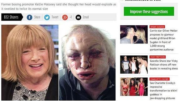 El antes y el después de Kellie. 