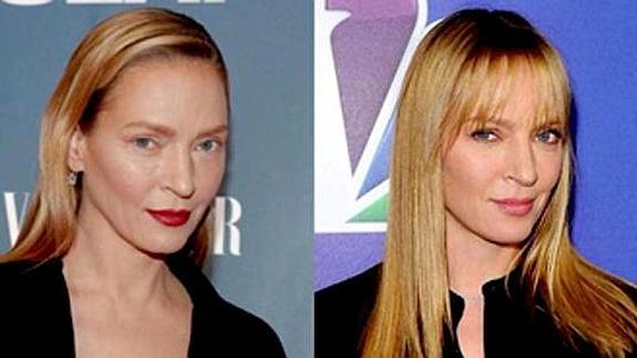 Los desastres más sonados en las cirugías de los famosos