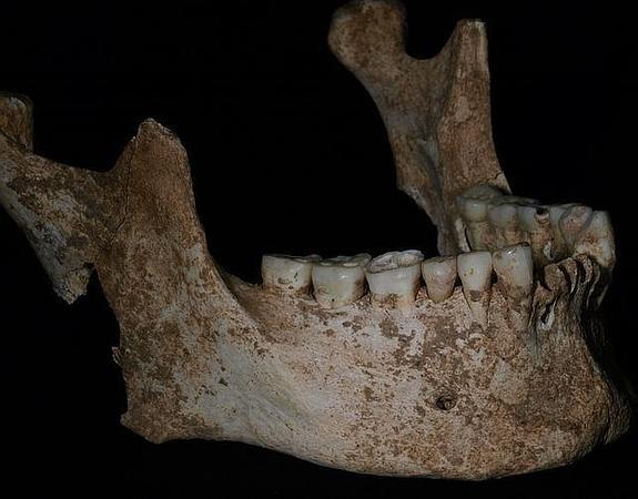 Mandíbula de Filipo II.