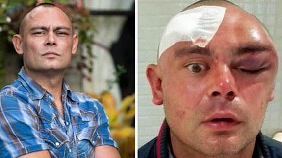 Un 'caníbal' destroza a mordiscos la cara de un DJ de Ibiza