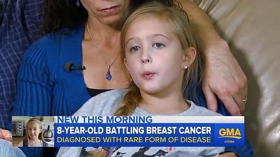 Una niña de 8 años padece cáncer de mama, la más joven del mundo en tenerlo