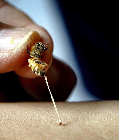 Que te pique una abeja, 'receta' para una piel perfecta