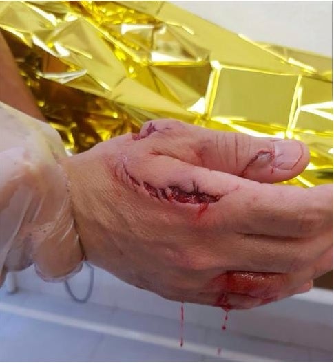 Un tiburón muerde a un bañista en Elche