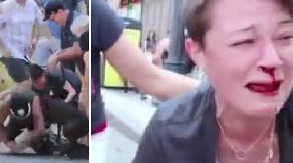 Una mujer salva la vida a su perro al meterse en medio del ataque de un pit bull