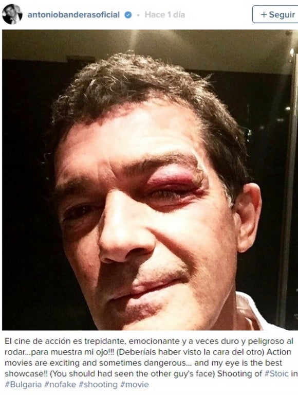 Antonio Banderas acaba con un ojo morado rodando con Paz Vega
