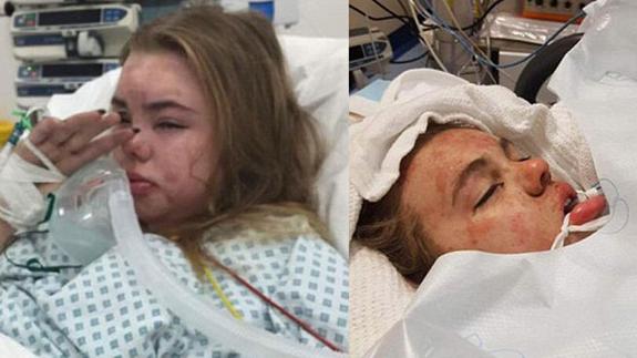 Utiliza la imagen de su hija en coma para avisar de los peligros del éxtasis