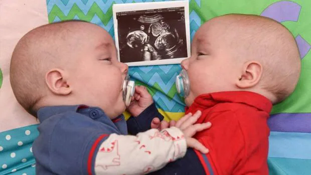 Estos gemelos salvaron su vida dándose la mano antes de nacer