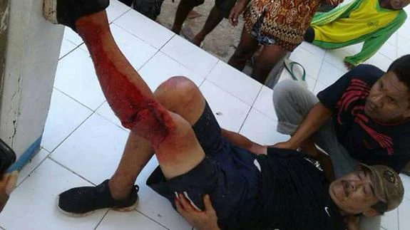 Un dragón de Komodo ataca brutalmente a un hombre en Indonesia