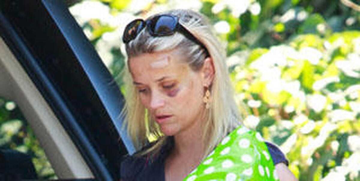 reese witherspoon parpadea abajo