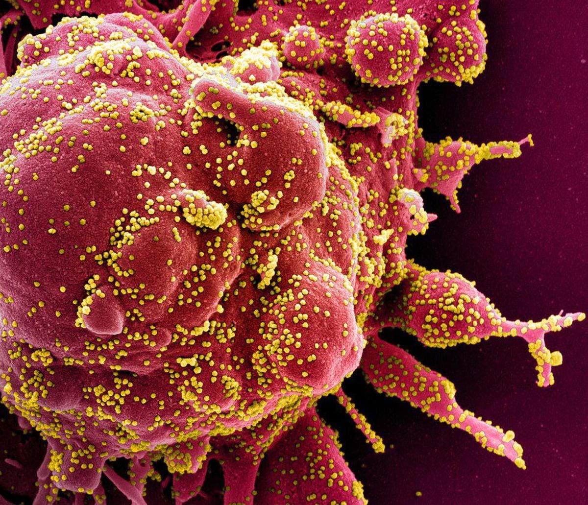 Imagen real del coronavirus a vista de microscopio.
