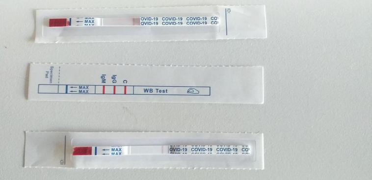 Test de anticuerpos COVID-19.