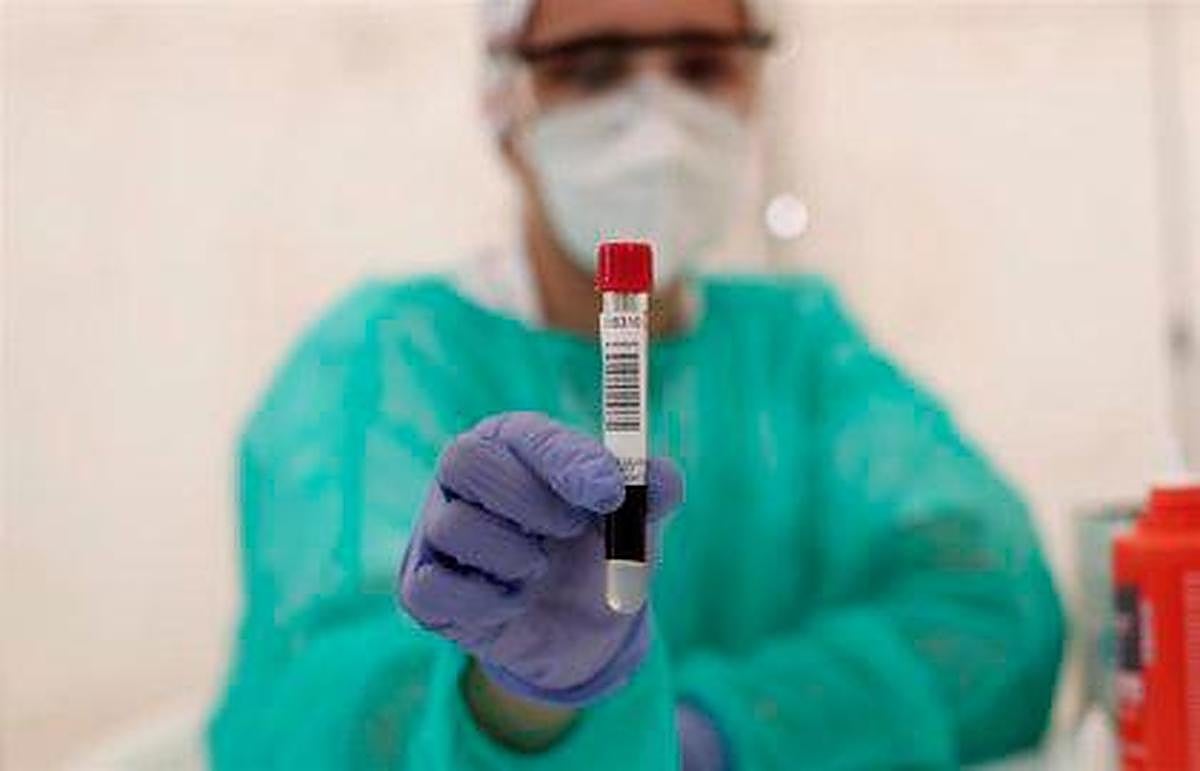 Los laboratorios siguen analizando test de COVID-19