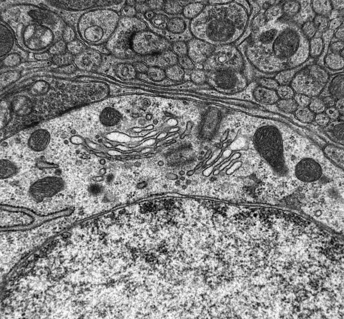 Detalle del proceso de sinapsis, por el que se transmite el impulso nervioso.