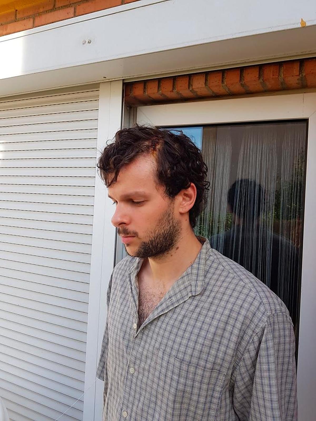 Ángel Carcaño muestra la enorme brecha que le produjo el golpe