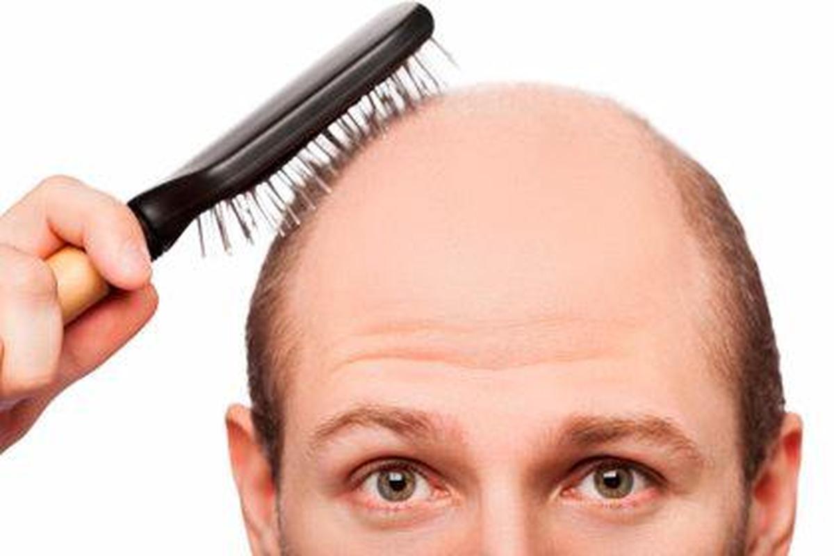 El ritual que ayuda a frenar la pérdida de pelo ante la llegada del otoño