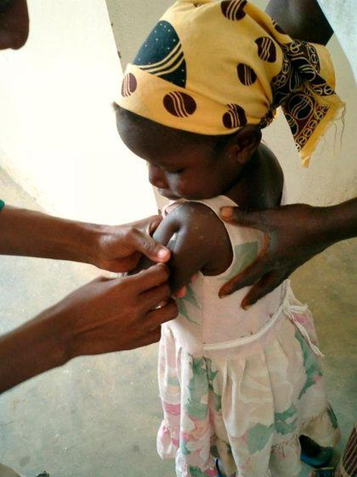 Una niña en un centro de salud de Mozambique recibe una inyección de la vacuna contra la malaria.