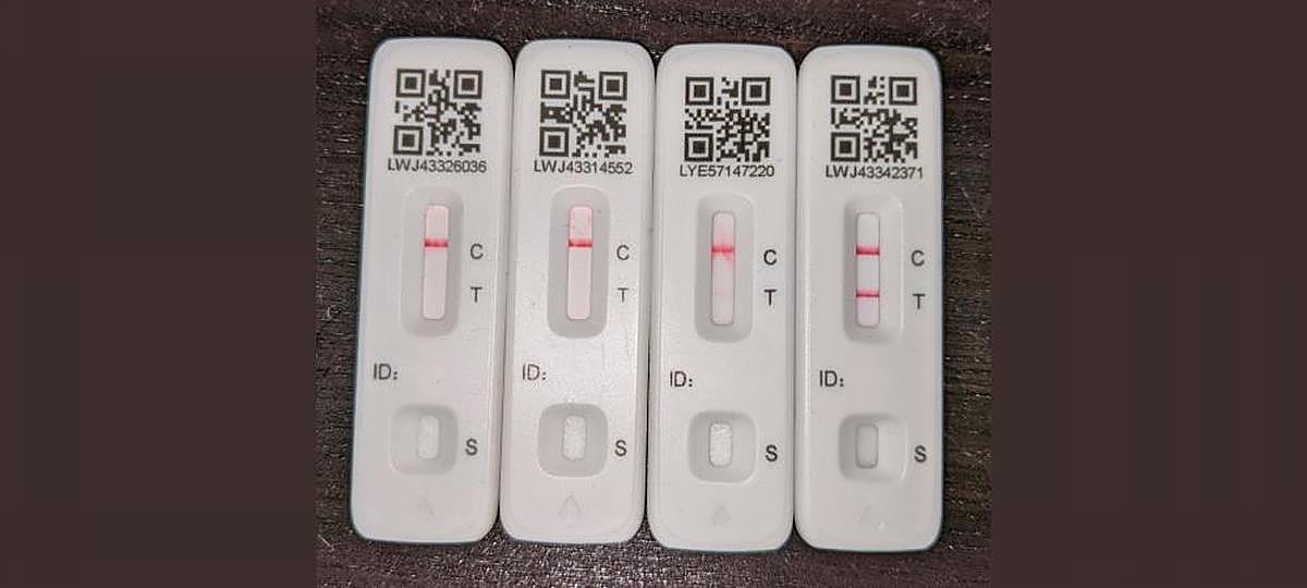 Un joven se sometió a cuatro test separados por unas horas y el cuarto -24 horas después del primero- confirmó un resultado positivo.