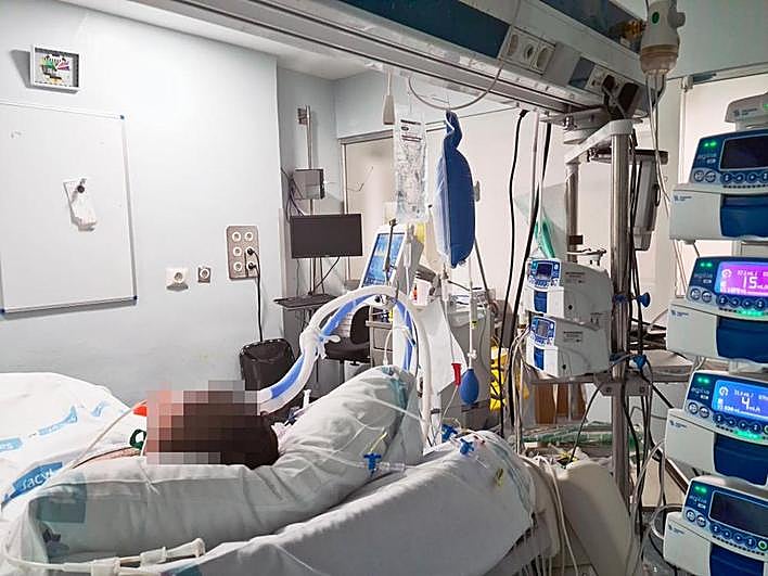 Un enfermo de coronavirus intubado