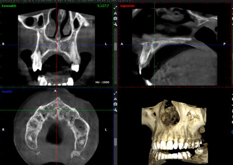 Así se usa la Inteligencia Artificial en odontología