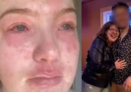 Virginia, un amor con tintes tóxicos: «Soy alérgica a mi novio»