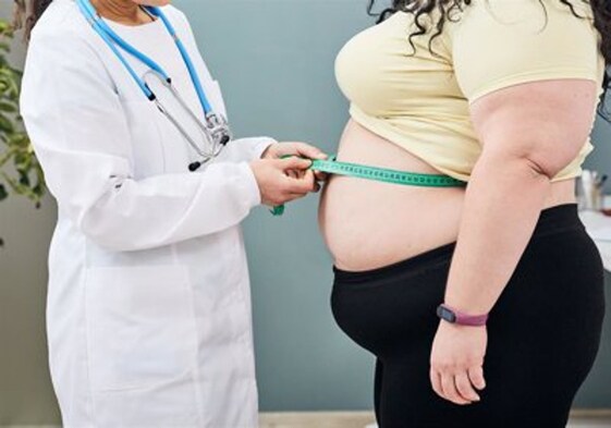 Los principales factores que aumentan el riesgo de padecer sobrepeso