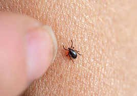 ¿Ha tenido que acudir a urgencias por alguna picadura en lo que va de verano?