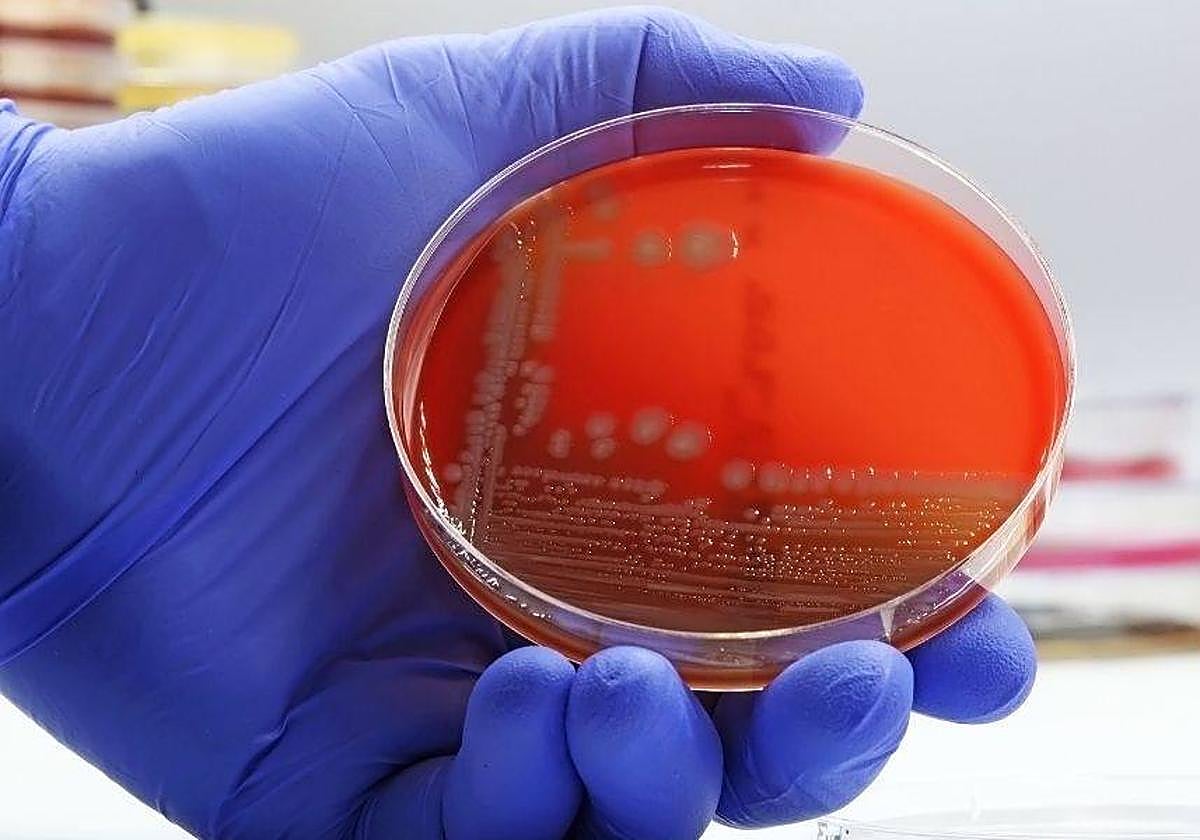 Poner en jaque unos Juegos Olímpicos a dejar a varios pueblos sin agua: qué es la bacteria E. coli y por qué es peligrosa | La Gaceta de Salamanca