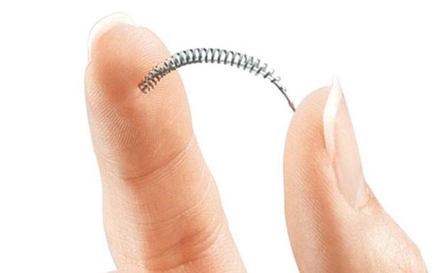 El anticonceptivo 'Essure'.