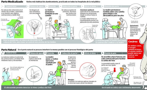 Gráfico. Las diferencias entre el parto medicalizado y el 'Natural'