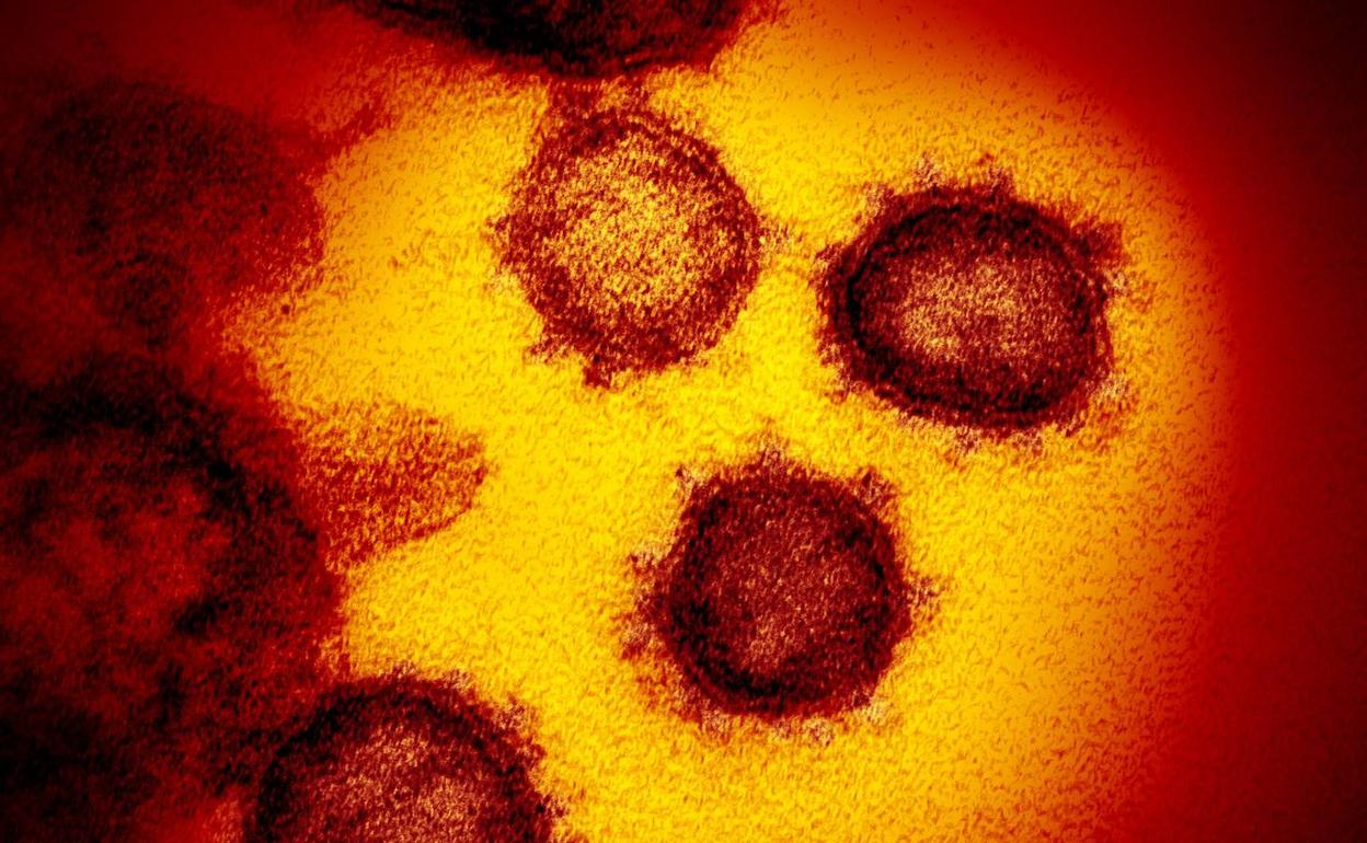 Imagen del coronavirus SARS-CoV-2, causante de la Covid-19, tomada con microscopio electrónico.