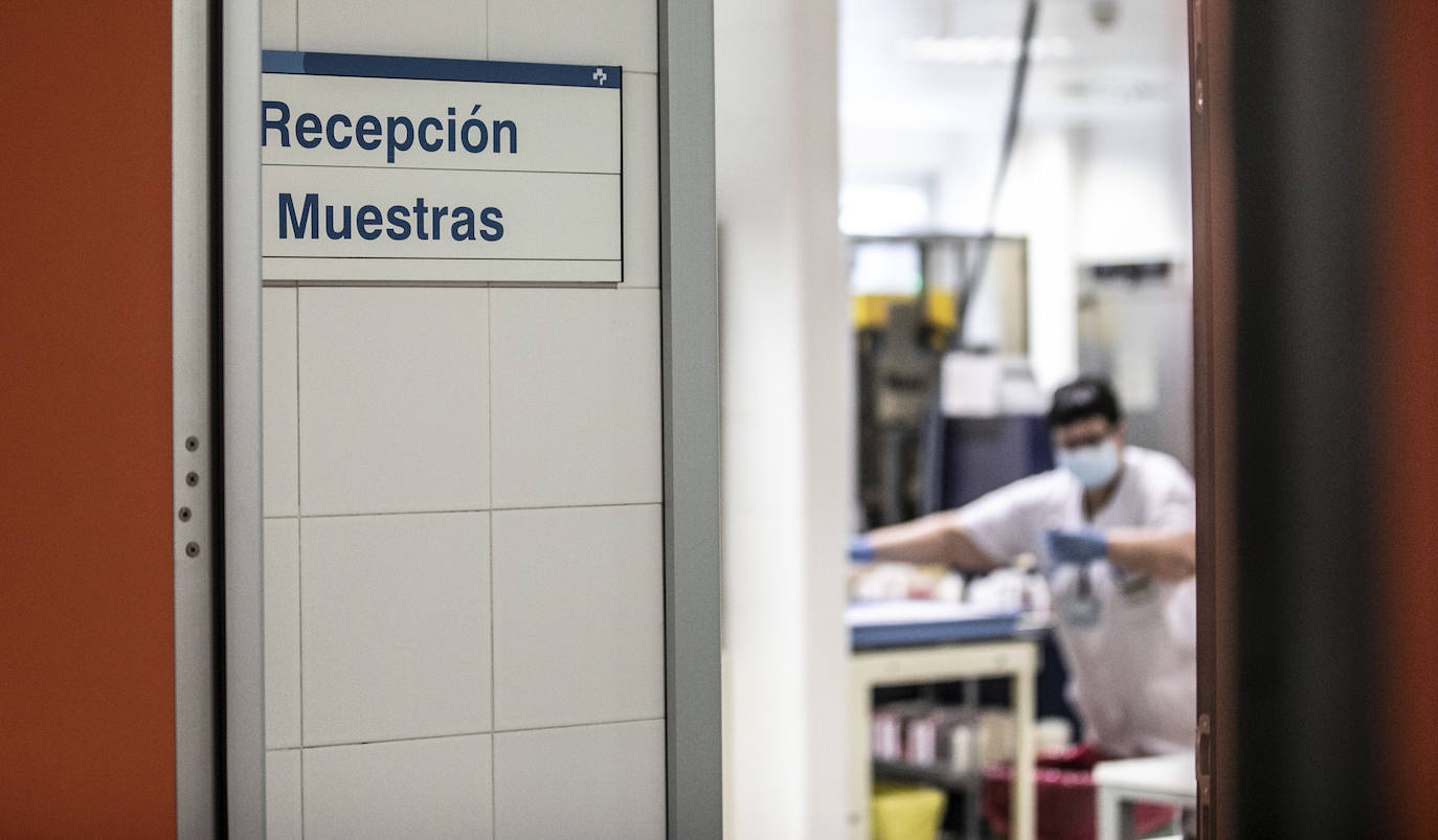 Fotos: Dentro del laboratorio de Microbiología del Hospital San Pedro