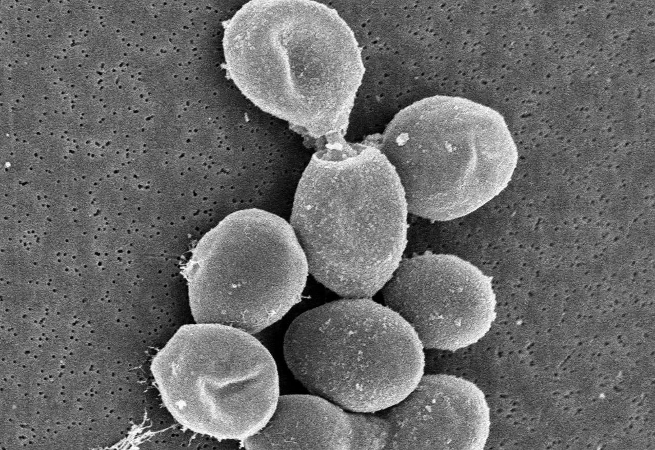 Imagen microscópica de la levadura Saccharomyces cerevisiae.